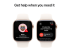 Apple Watch Series 10 (GPS + Cellular) - Multi-angle